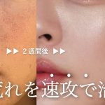 【毛穴ゼロむき卵肌🥚】つるつる美肌に速攻なれる､敏感肌向けホームスキンケア9選🧴❄️