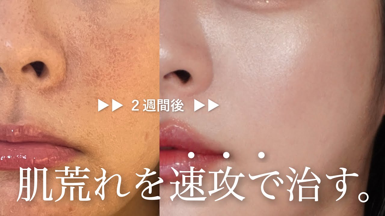 【毛穴ゼロむき卵肌🥚】つるつる美肌に速攻なれる、敏感肌向けホームスキンケア9選🧴❄️