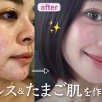 【🥚毛穴レス＆透明感🫧】うるツヤ美肌を作る、最強スキンケアを全て教えます🧖🏻‍♀️🩵